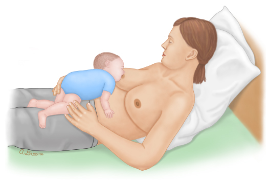 BODY ICE Woman - HEALING💕 Sore nipples are very common for breastfeeding  women. Common causes may include: • a baby not latching well • chafing •  thrush • adapting to this new
